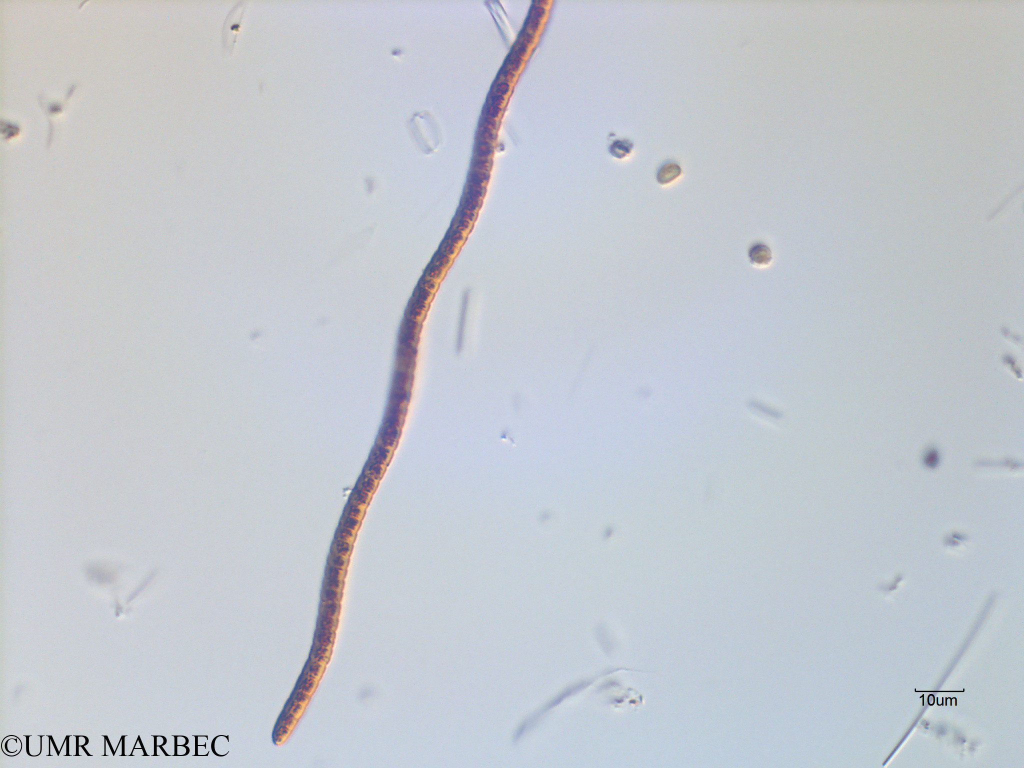 phyto/Scattered_Islands/mayotte_lagoon/SIREME May 2016/Oscillatoriale spp (MAY11_cyano4-4).tif(copy).jpg